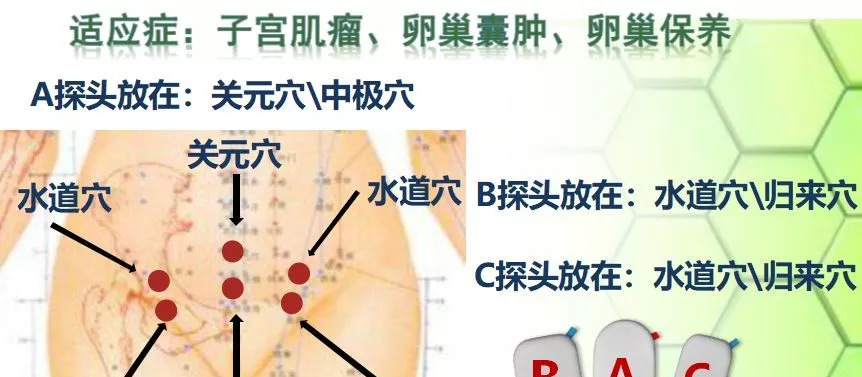 乳腺癌最新治疗方案，科学进步与个性化治疗的融合